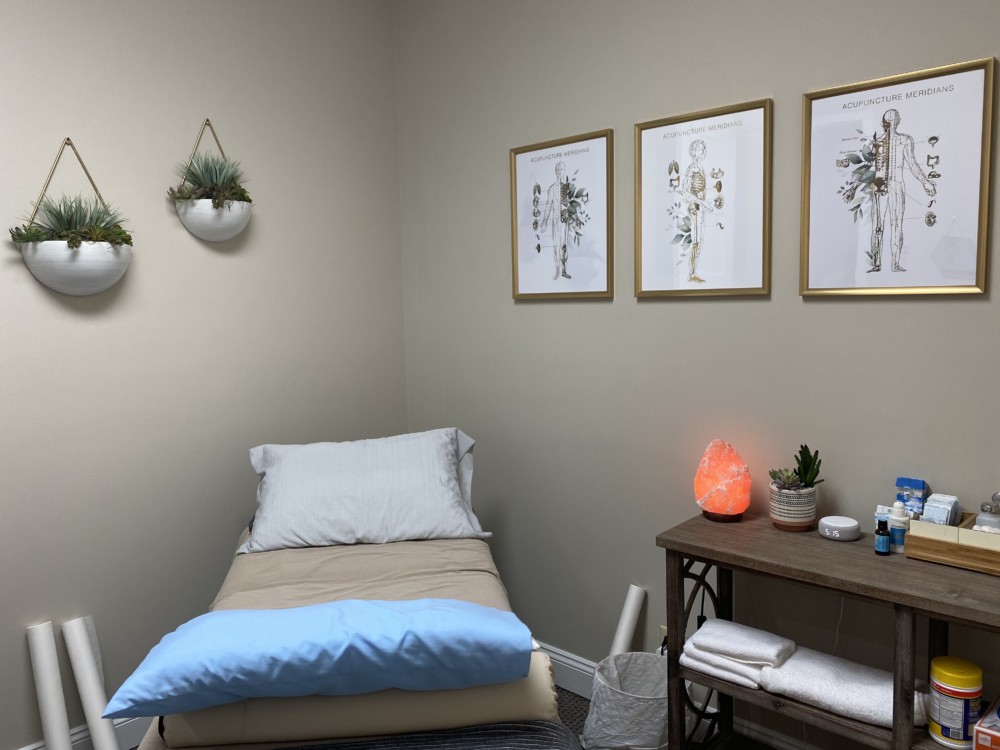 Acupuncture for Stress Relief at Reclaim Wellness
